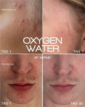Oxygen Water 4 Week | Toner gegen Unreinheiten (4x50ml)